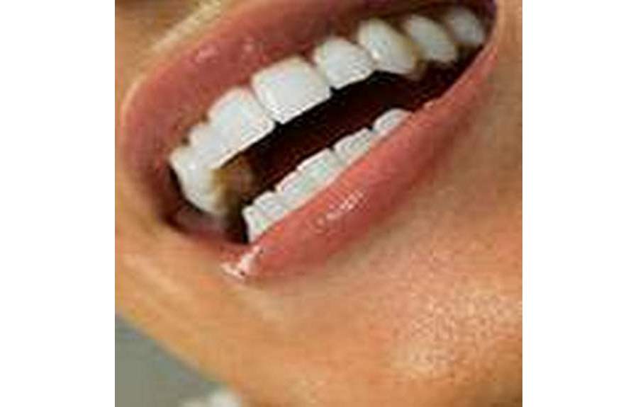 Красивые и белые зубы — секрет вашей привлекательности